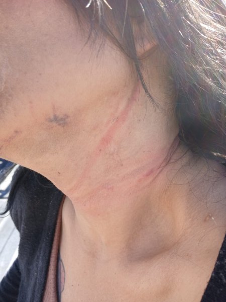 Policías municipales evitan tragedia y rescatan a mujer en canal de la Luis Olague