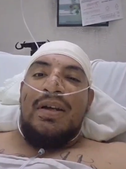 Sergio, chofer lesionado en accidente del Libramiento, agradece apoyo de los juarenses mientras espera cirugía